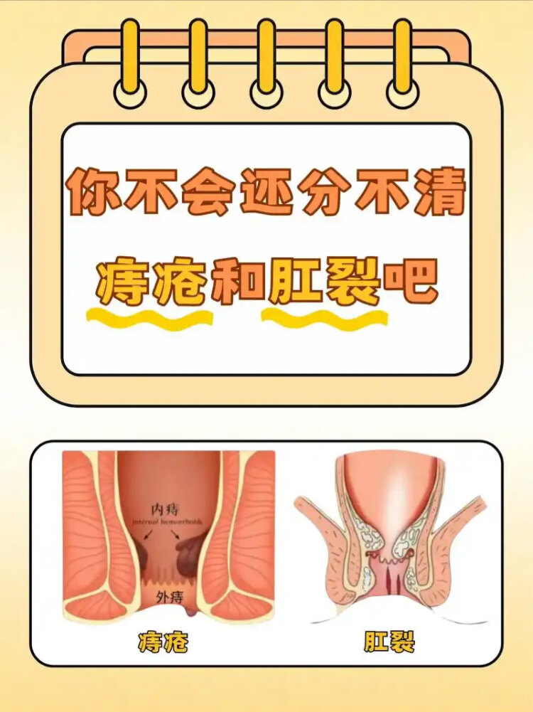 根据肛门括约肌压力将肛裂分为痉挛型,正常型和松弛型
