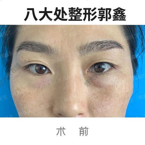 圖文圖片