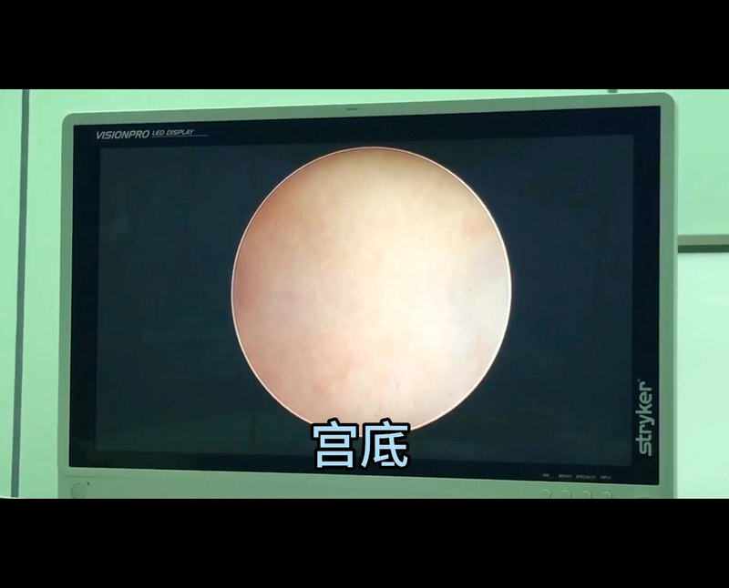 視頻封面