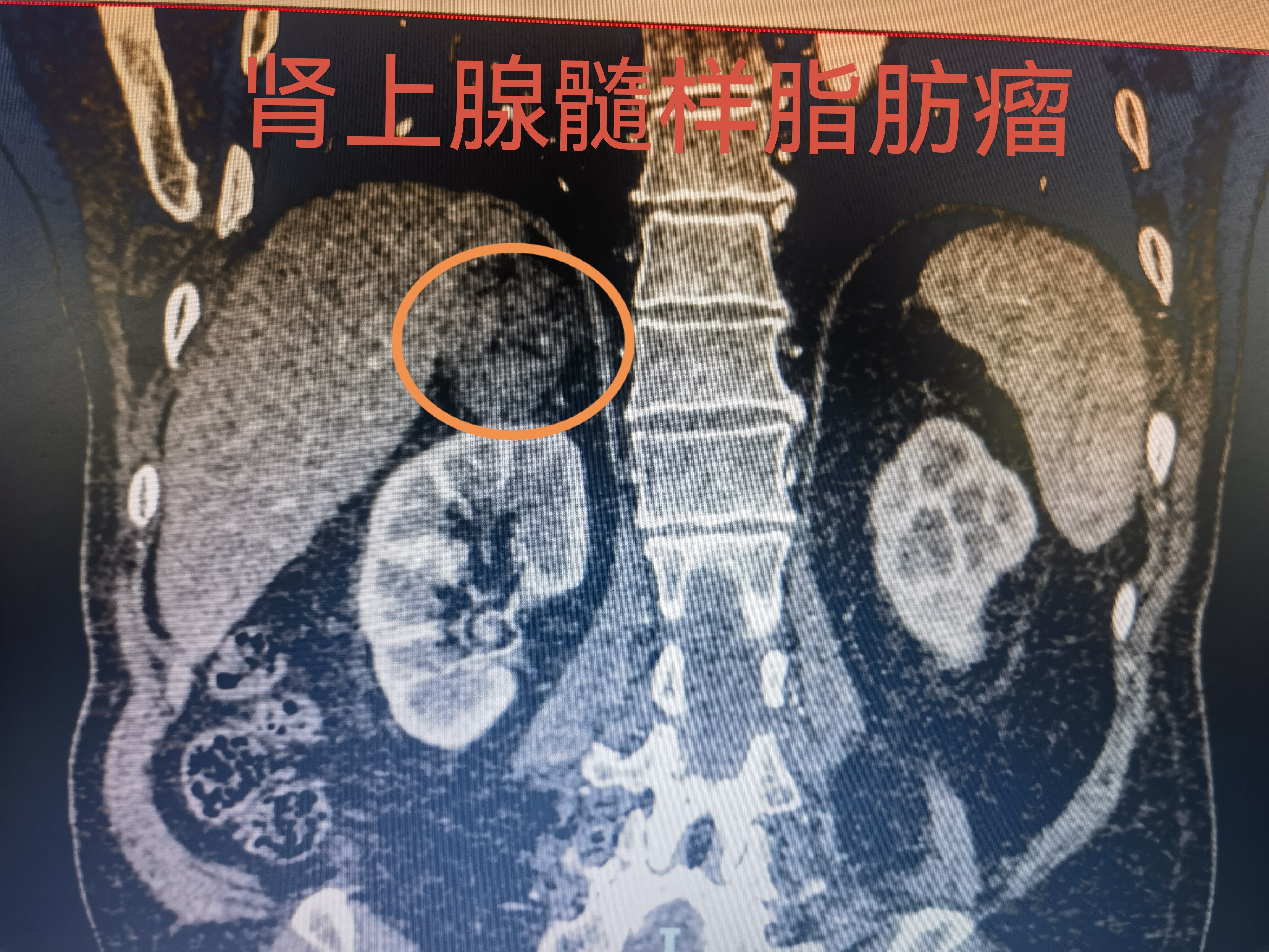 圖文圖片