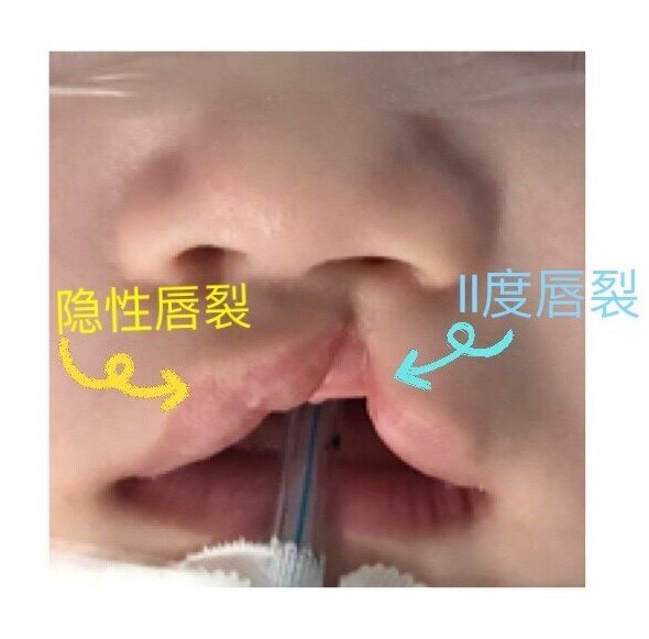 圖文圖片