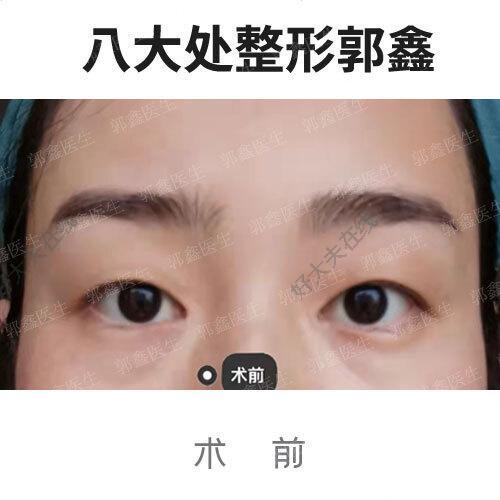 圖文圖片
