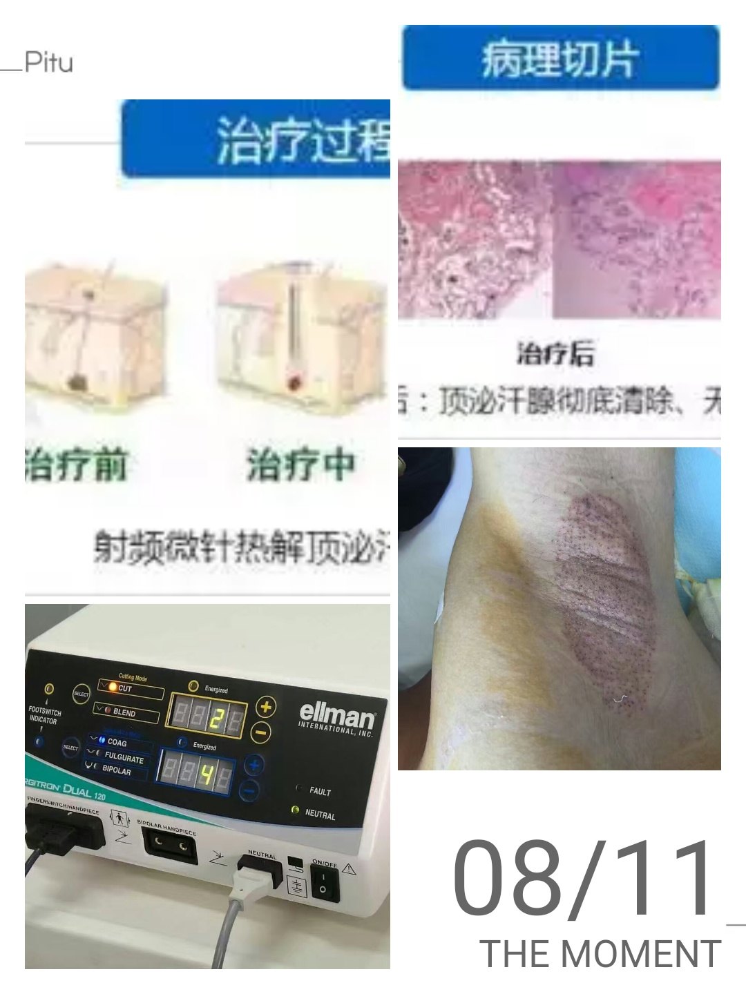 暂无