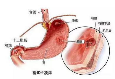 暂无