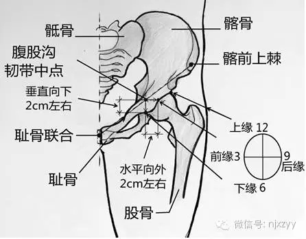 股骨粗隆间的位置图图片