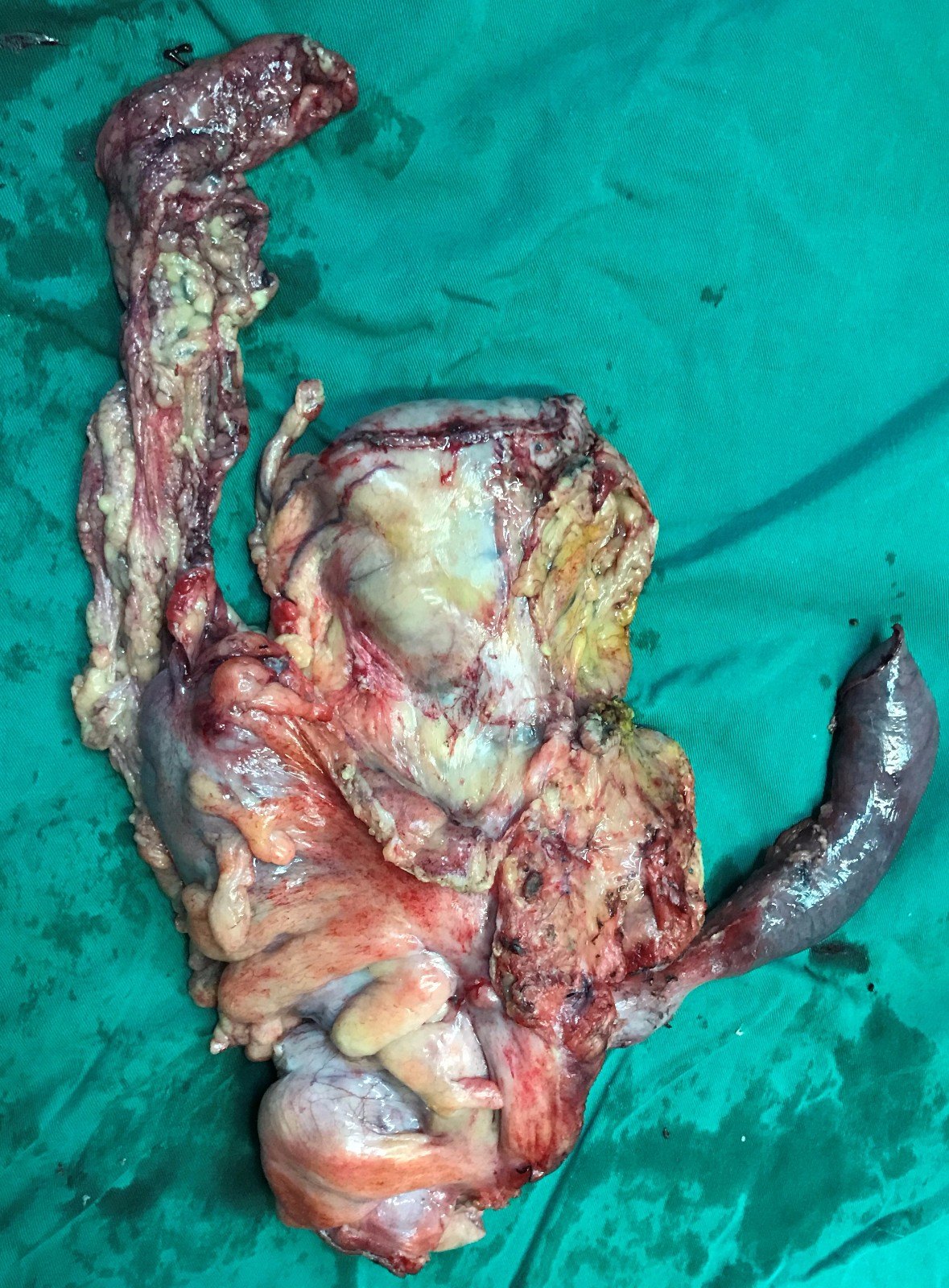 航天总医院重症中心大夫名单黄牛随时帮患者挂号的简单介绍 航天总医院重症中心大夫名单黄牛随时帮患者挂号的简单介绍