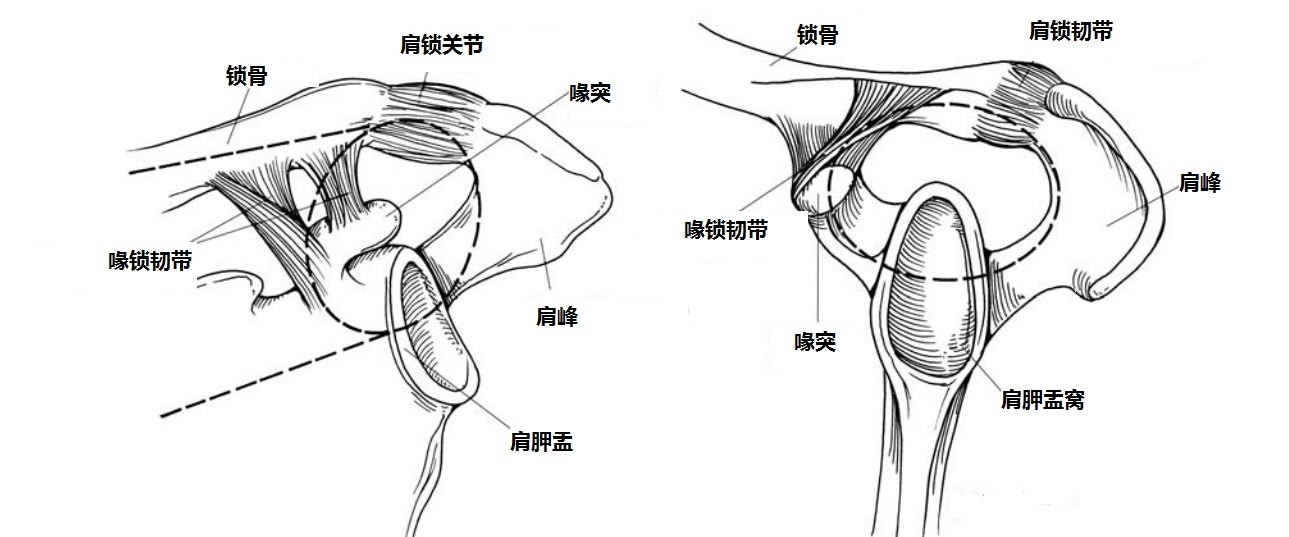 肩胛骨的骨折,但是,现在,我们认识到:韧带断裂也可导致浮肩