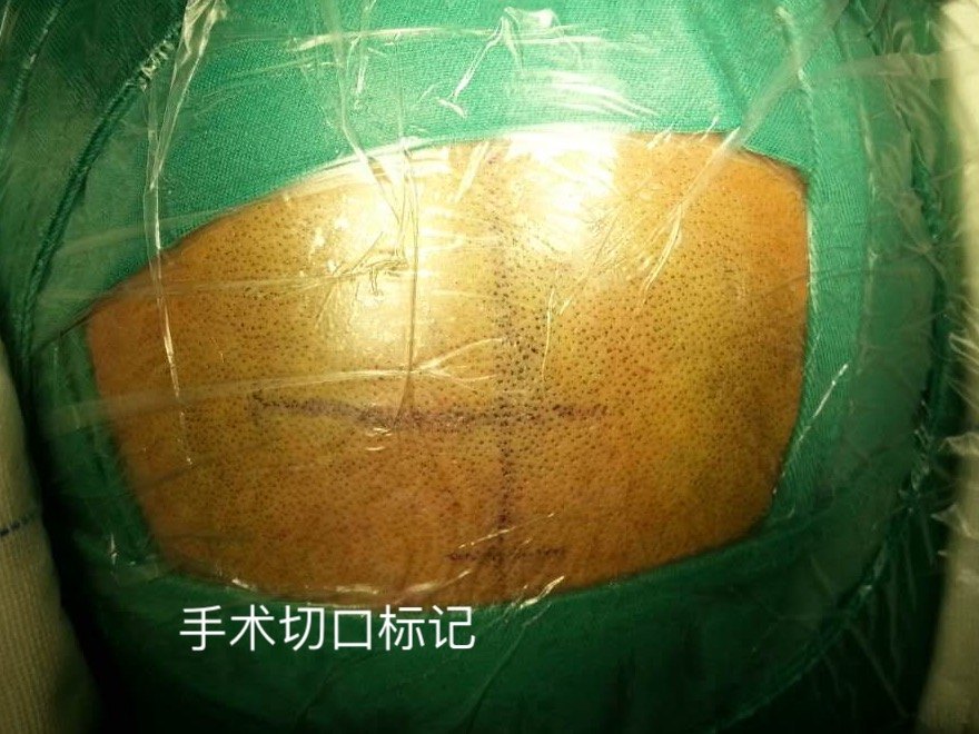 0类切口 mip.haodf.com