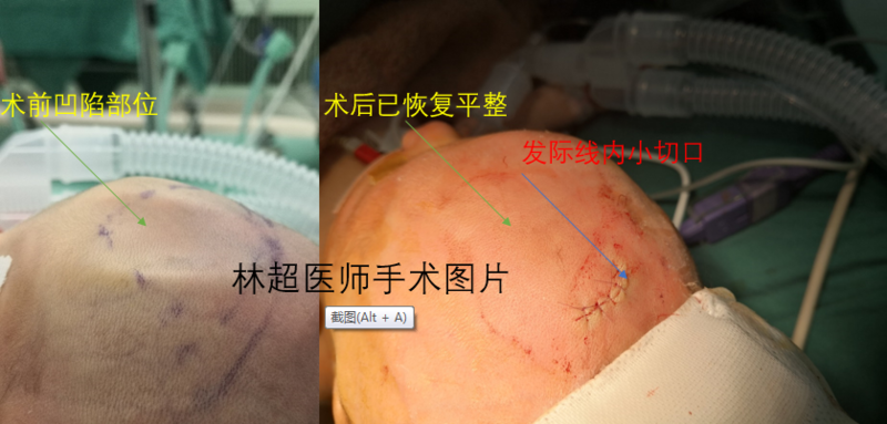 圖文圖片