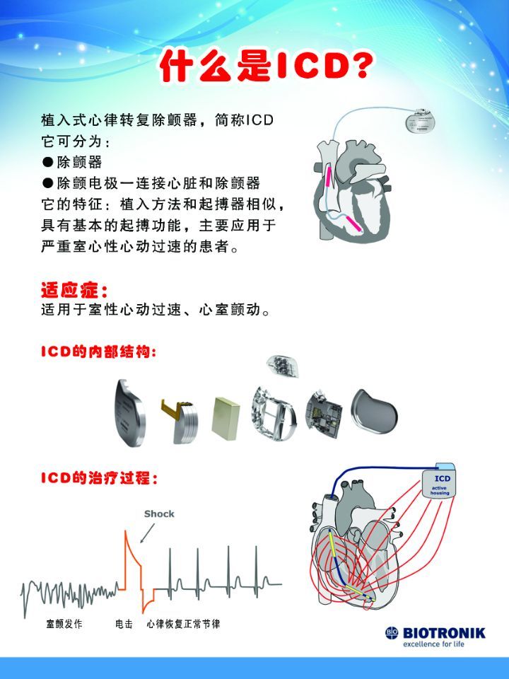 几种特殊起搏器