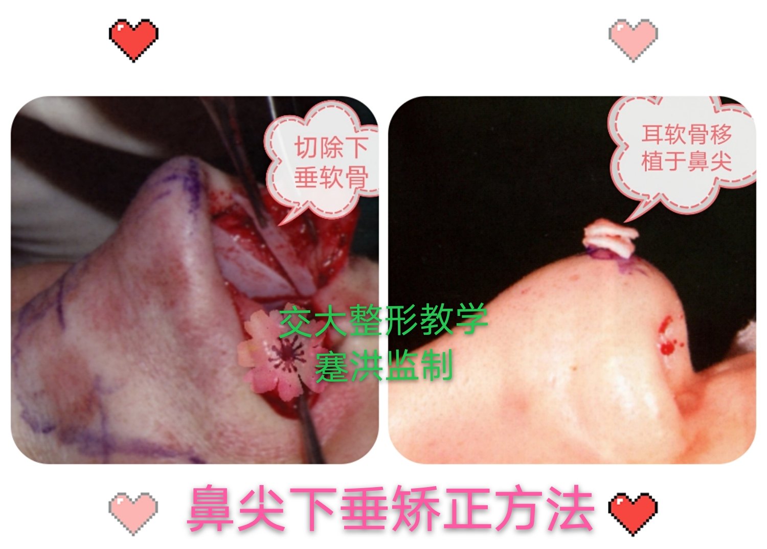 暂无