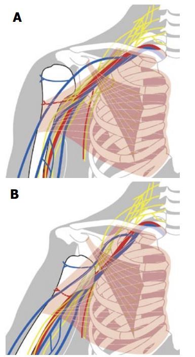 hippocratic希波克拉肩关节脱位复位法有血管神经损伤的危险么?