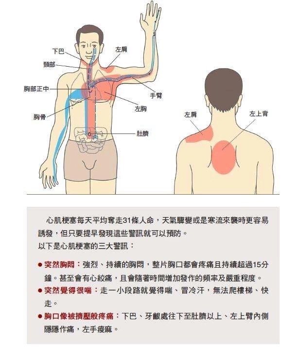 冠心病疼痛部位图口诀图片