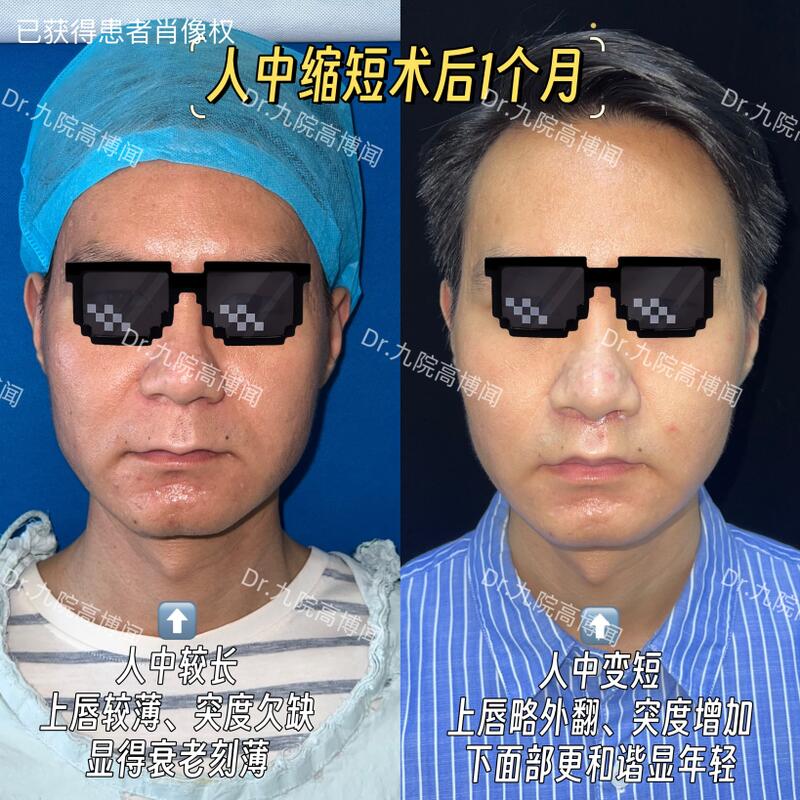 圖文圖片