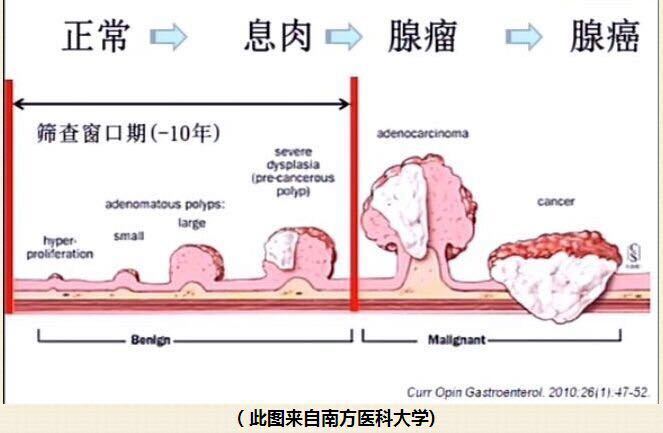 山田息肉分型图谱图片