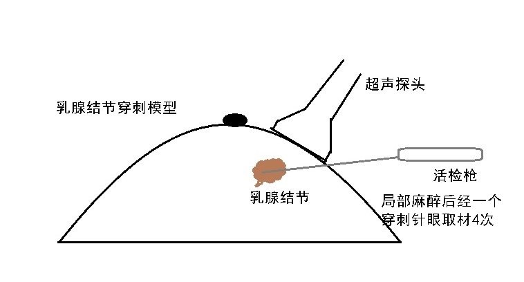 乳腺穿刺模型.jpg