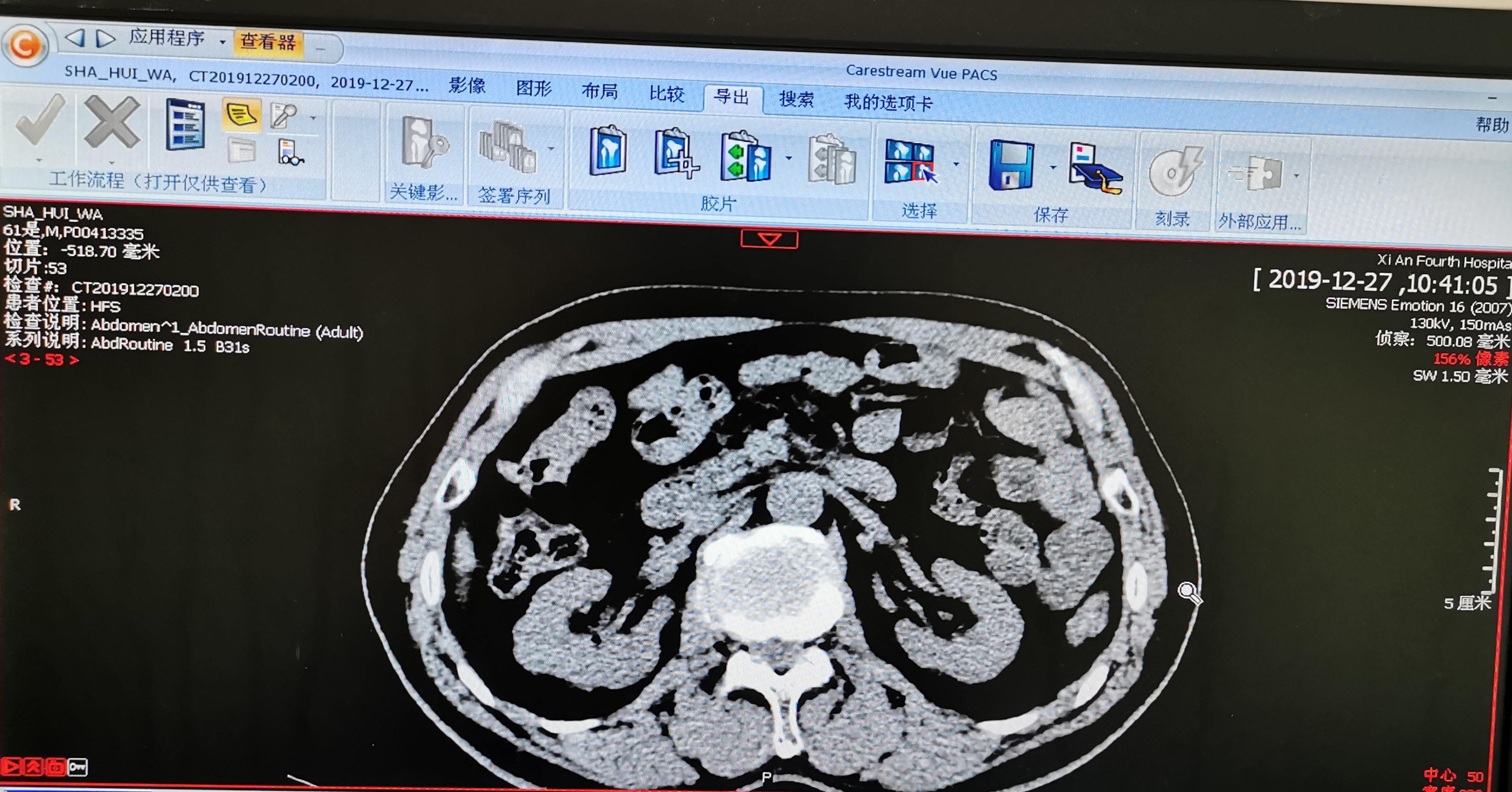 友来特溶石实验图片