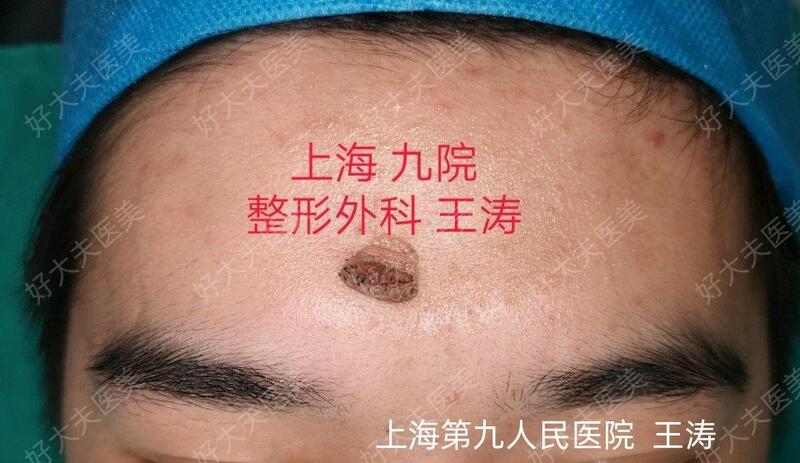 圖文圖片