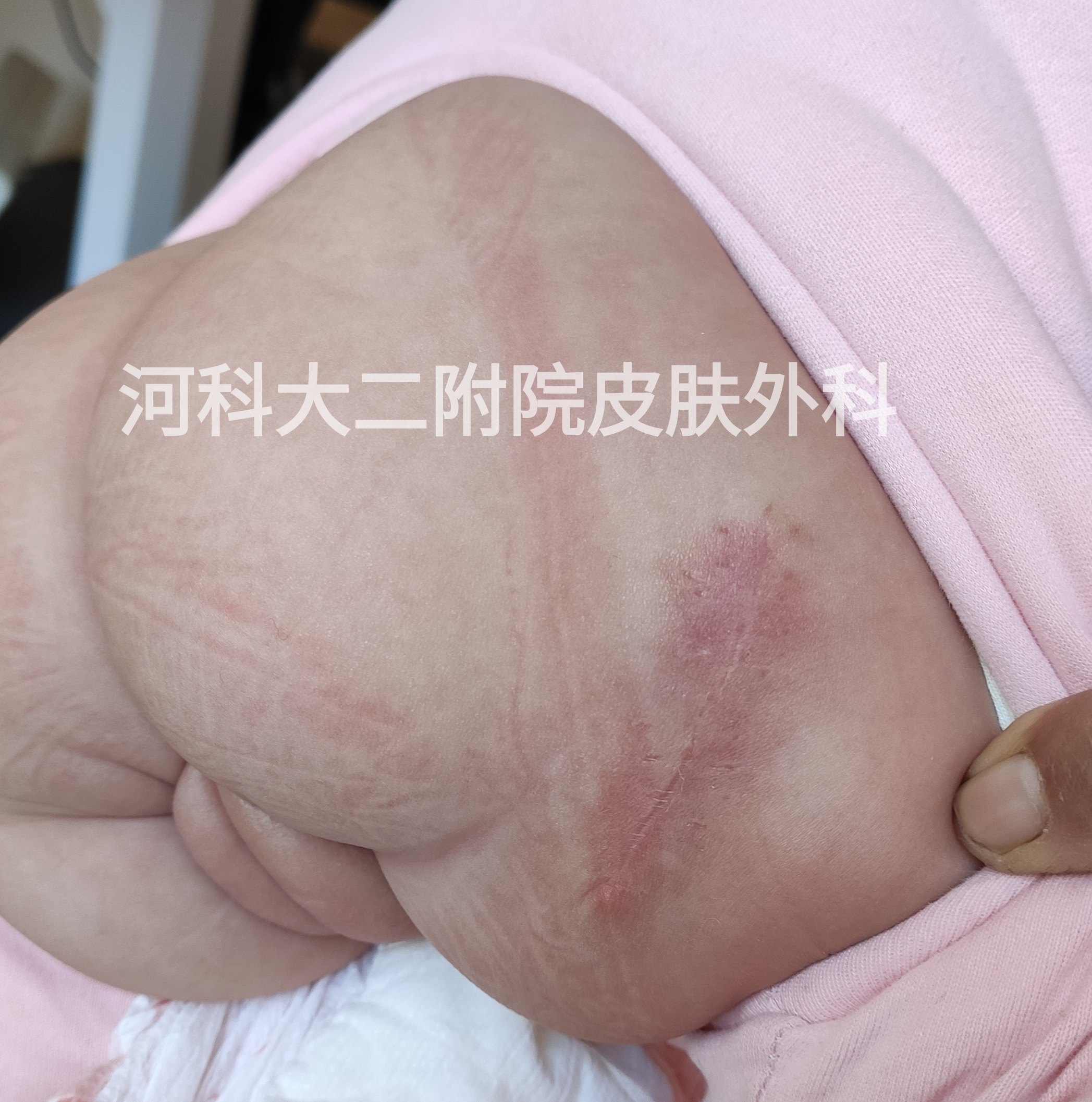 暂无