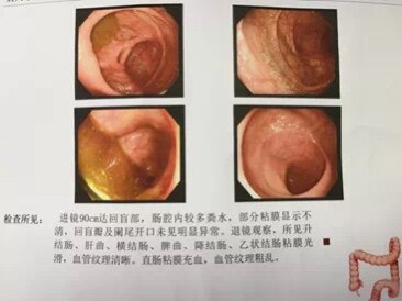 暂无