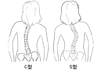 儿童脊柱正常形状图片图片