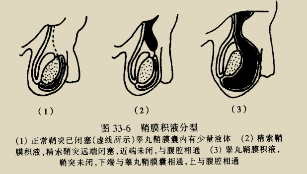 圖文圖片