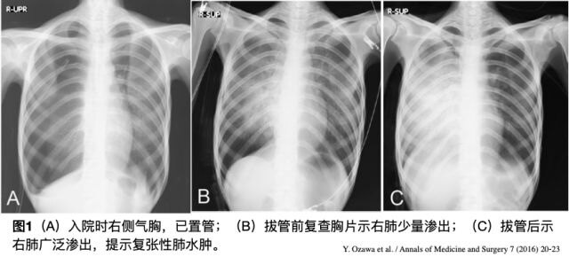 水肿性团块图片