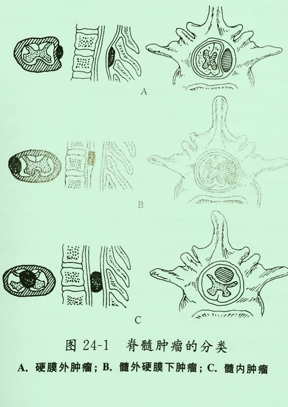 圖文圖片