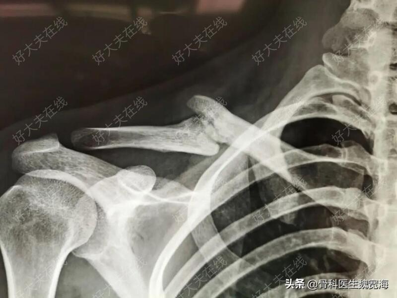 圖文圖片
