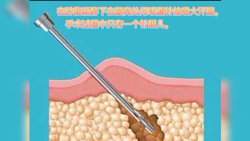 視頻封面