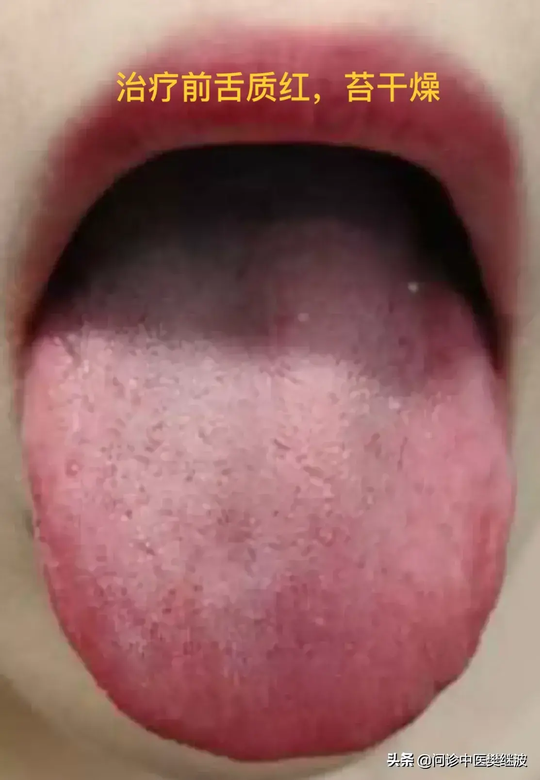 暂无