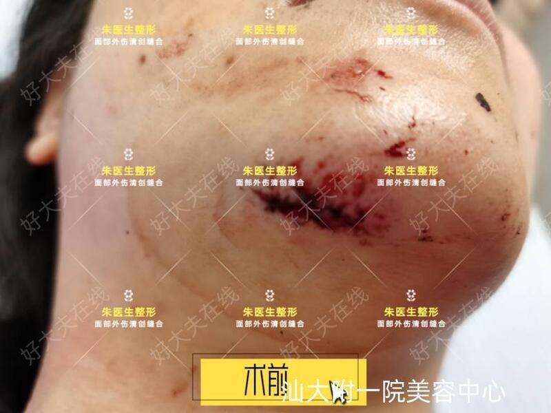 圖文圖片
