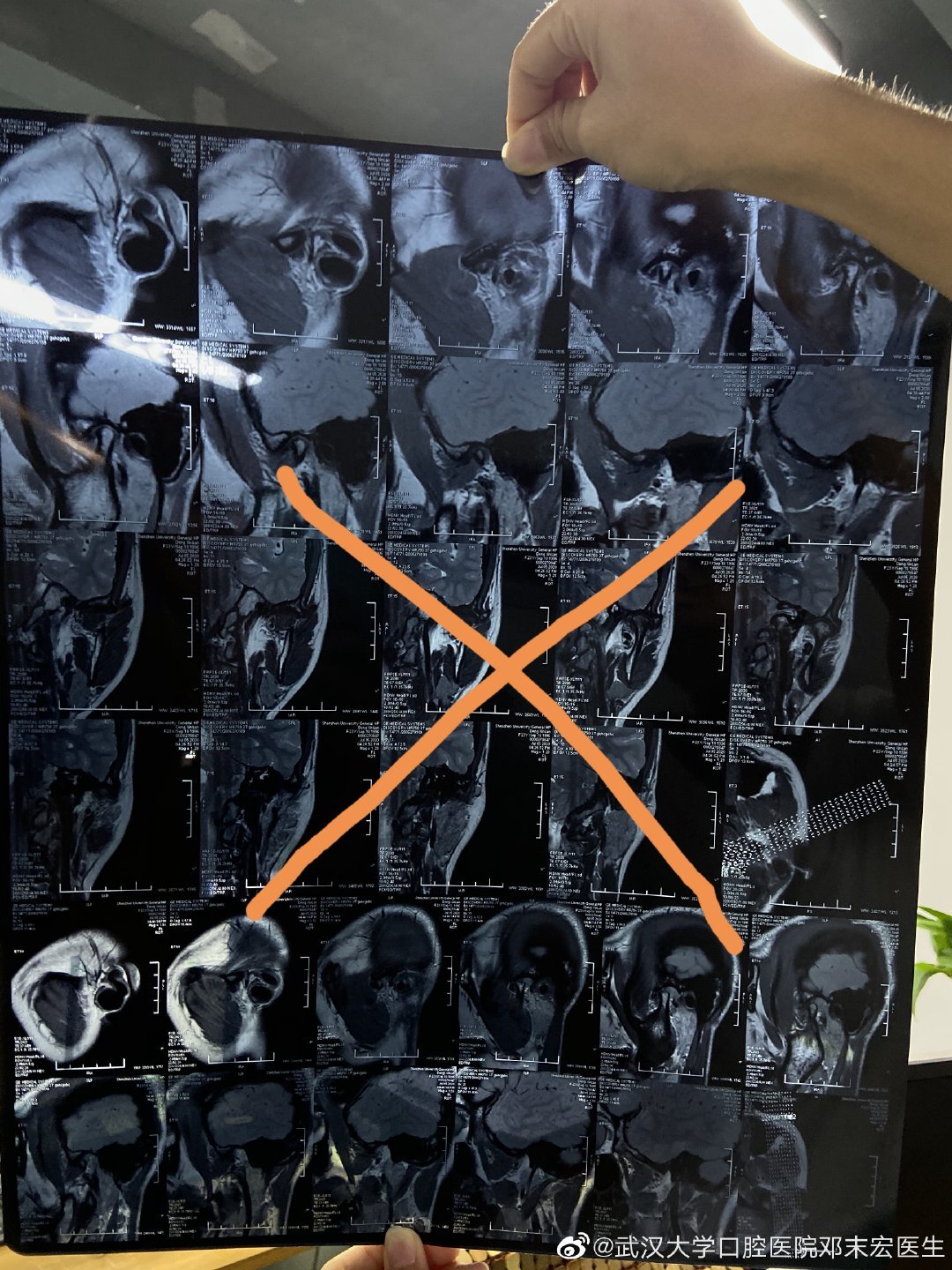 颞下颌关节病网上问诊怎么上传图片