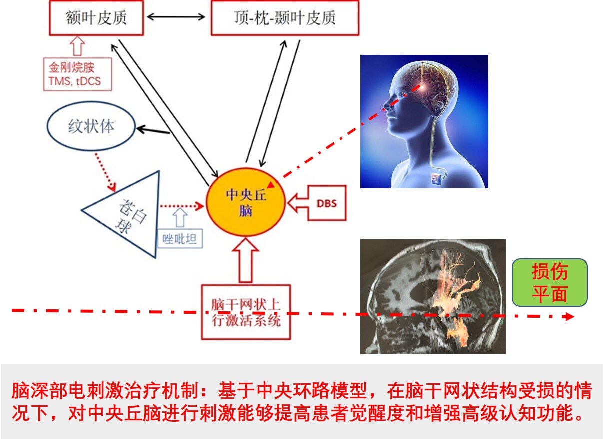 中央环路治疗机制.jpg