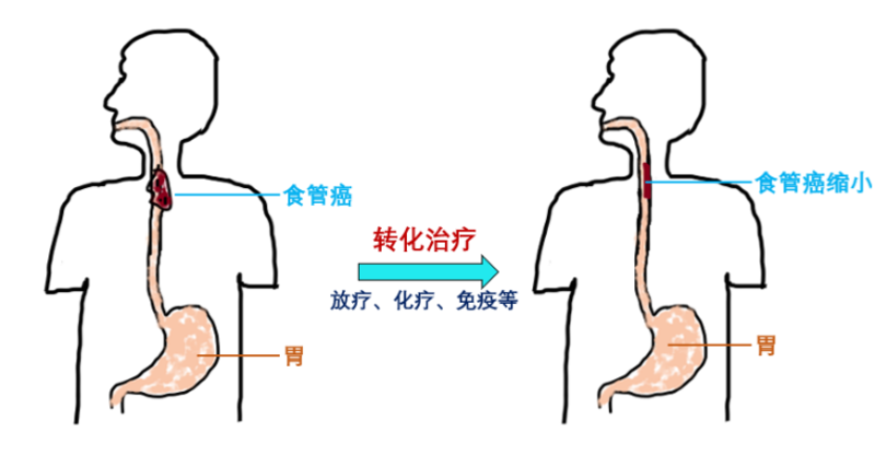 圖文圖片