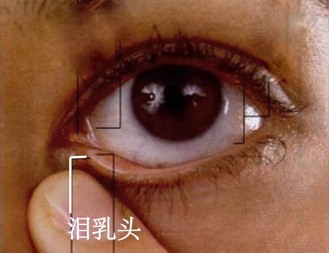 泪阜:眼角处有一个红色的内部结构,它是一块隆起的组织.