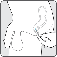 核酸检测肛拭子姿势图片