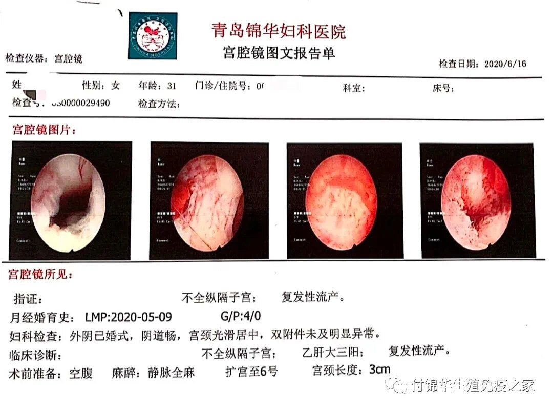 談談雙子宮縱隔子宮對妊娠的影響