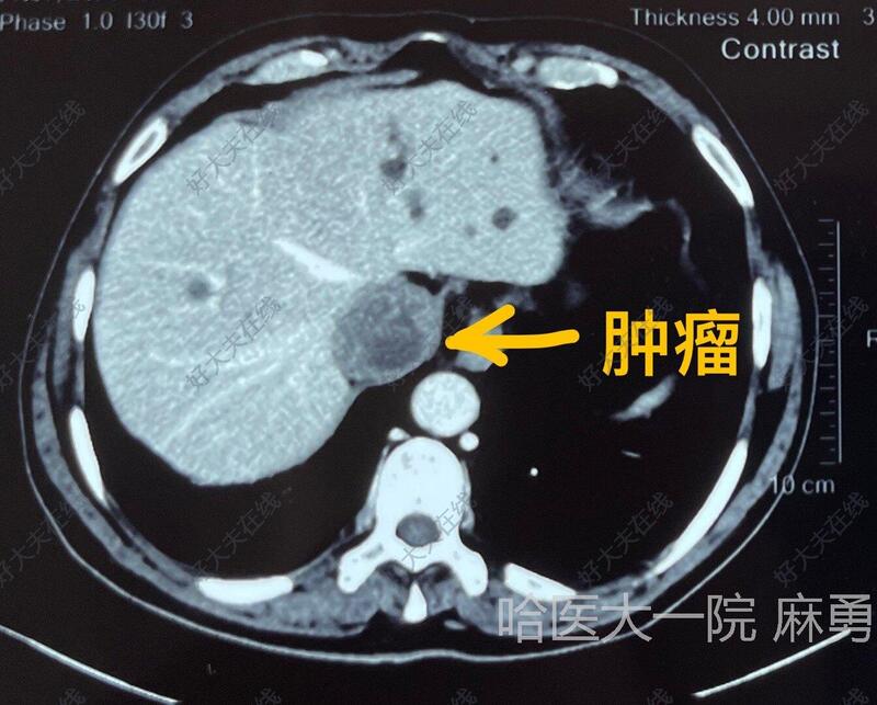 圖文圖片