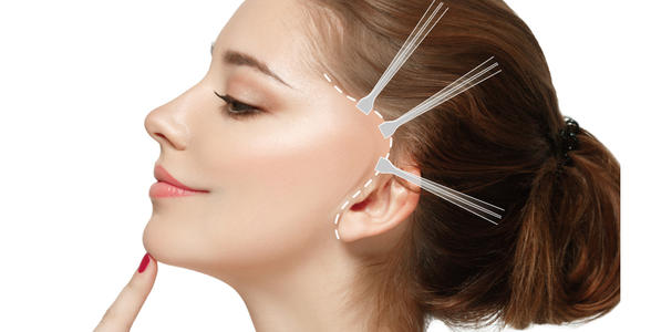 做拉皮手术的常见误区有哪些价格一般是多少