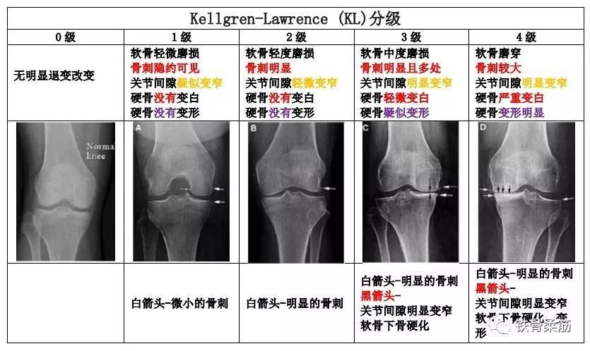 膝关节炎和广场舞,太极拳_膝关节炎 - 好大夫在线