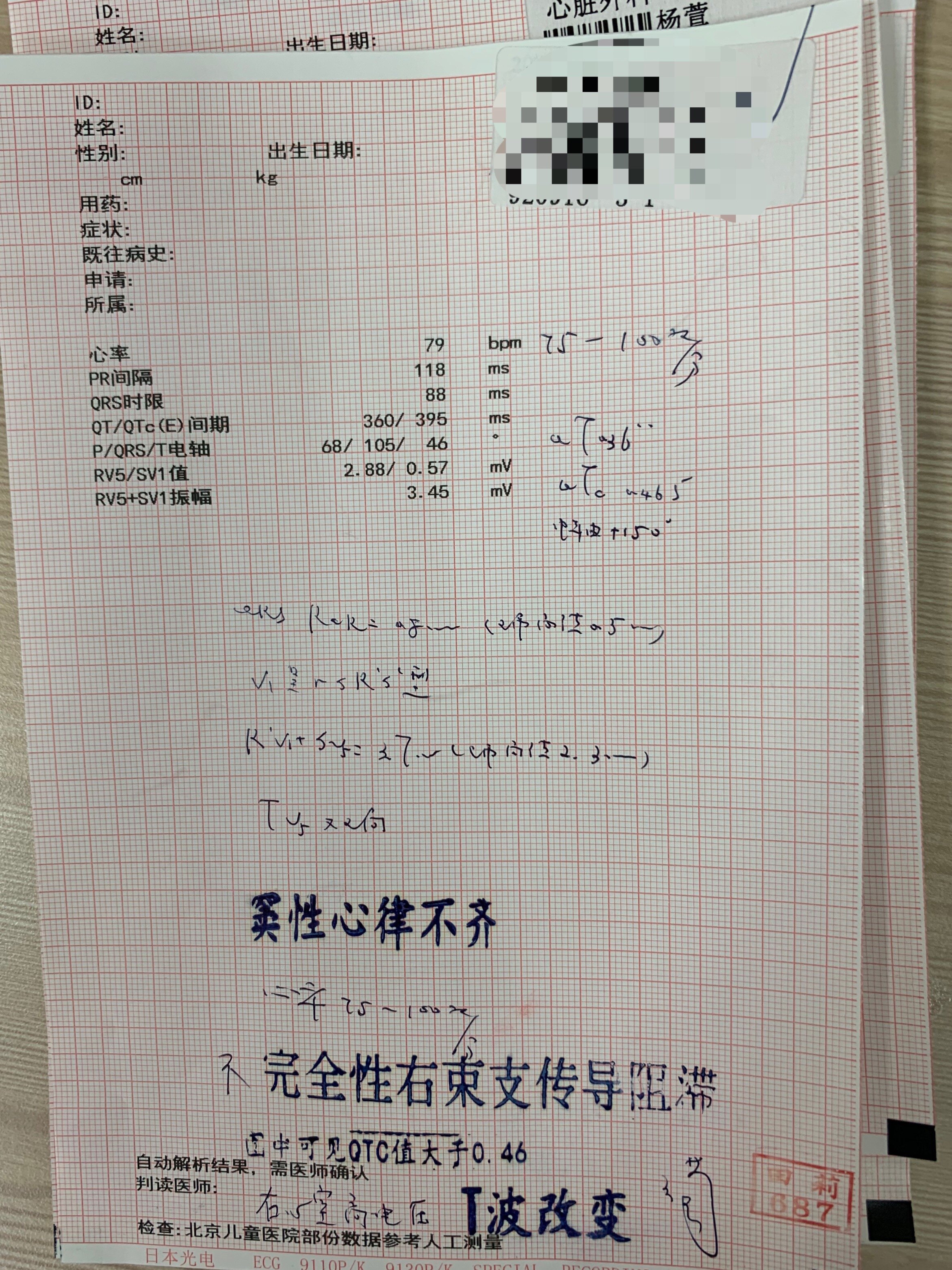 先天性心脏病术后 窦性心律 小儿心律失常 先天性心脏病术后 窦性心律 小儿心律失常