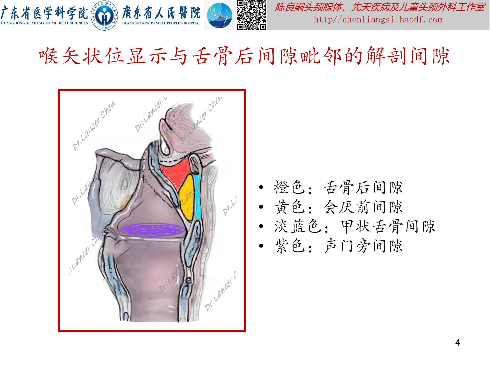 20240621：医学科普——百密一疏：舌骨后间隙的忽略，可导致甲状舌管囊肿术后复发_04.jpg