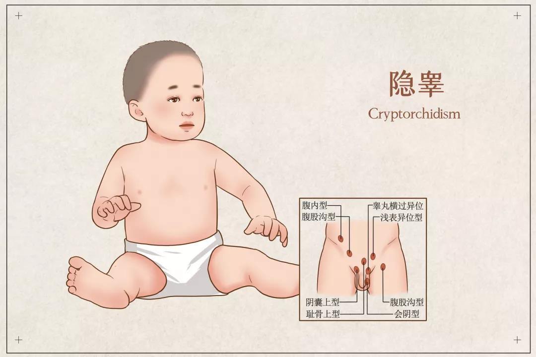 婴儿正常阴囊的图片图片