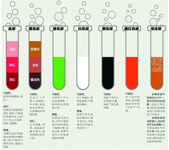 帮您了解尿液颜色的秘密