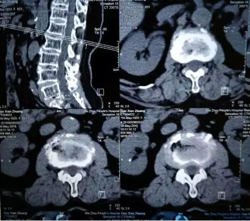 在家如何清晰拍照医学影像学图片上传给医生