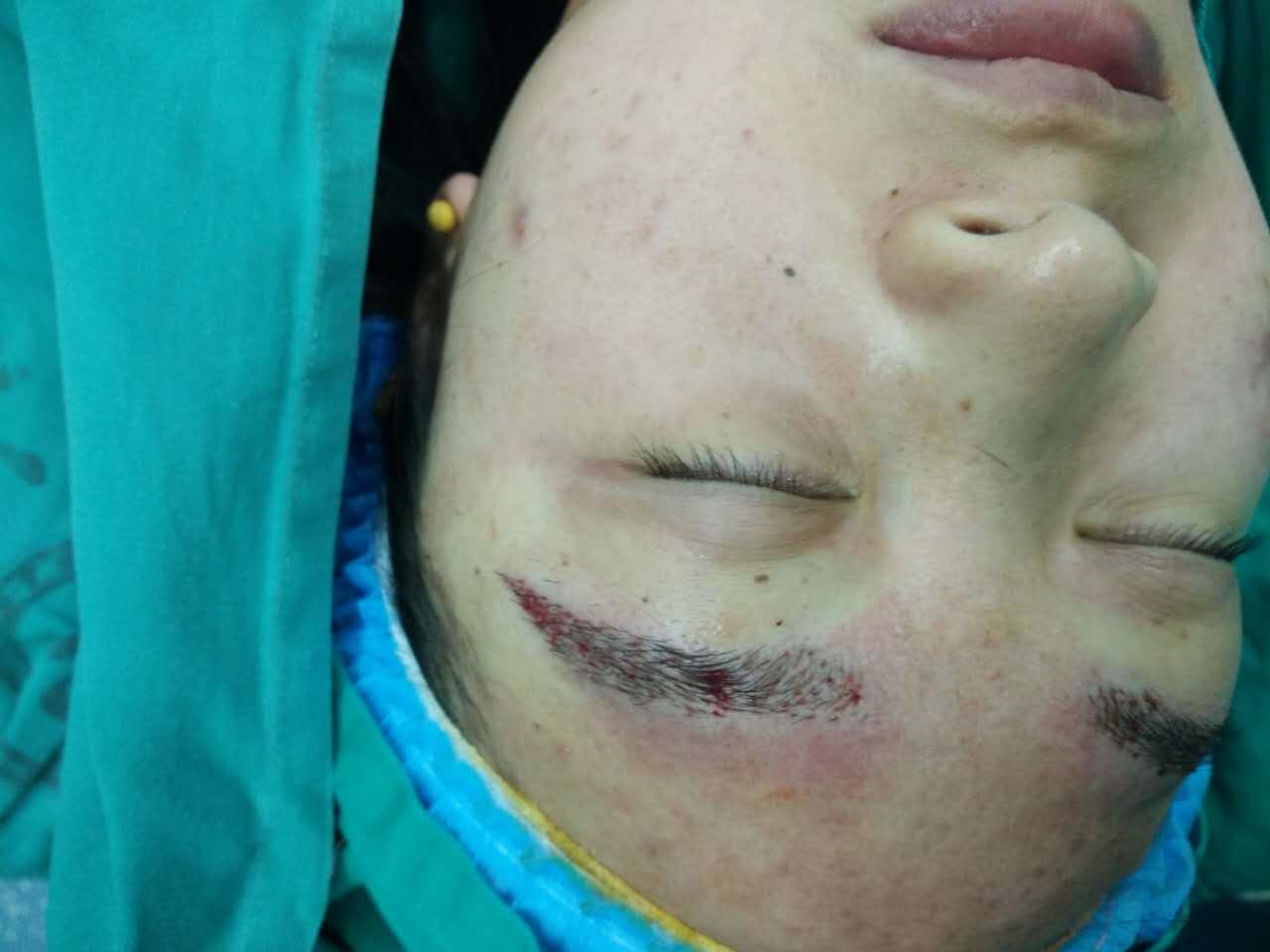 27烧伤与修复重建外科崔正军邹仕波黄世磊此次培训班为全省烧伤整形