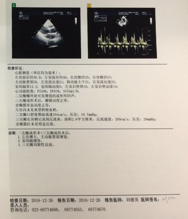 二尖瓣狭窄超声报告图片