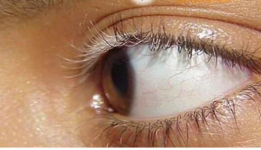 白癜风眉毛也变白怎么办 - 好大夫在线