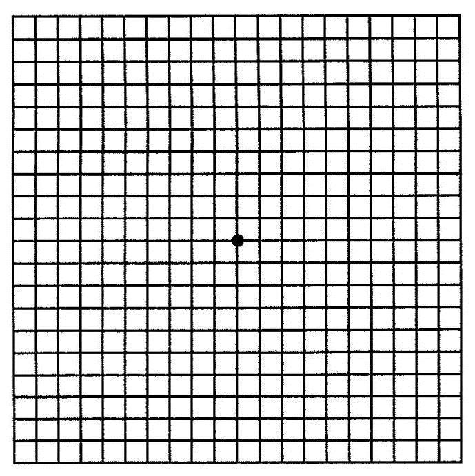 自测黄斑病变的方格图图片